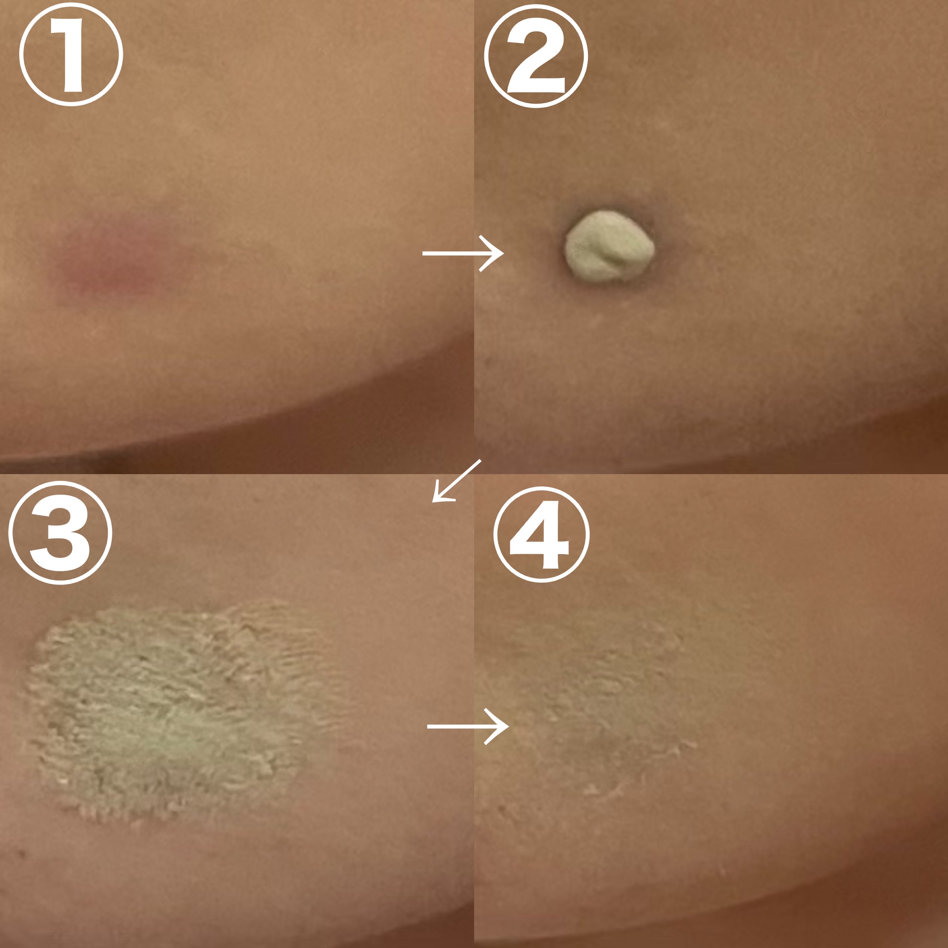 カバーパーフェクション チップコンシーラー/the SAEM/リキッドコンシーラーを使ったクチコミ（3枚目）