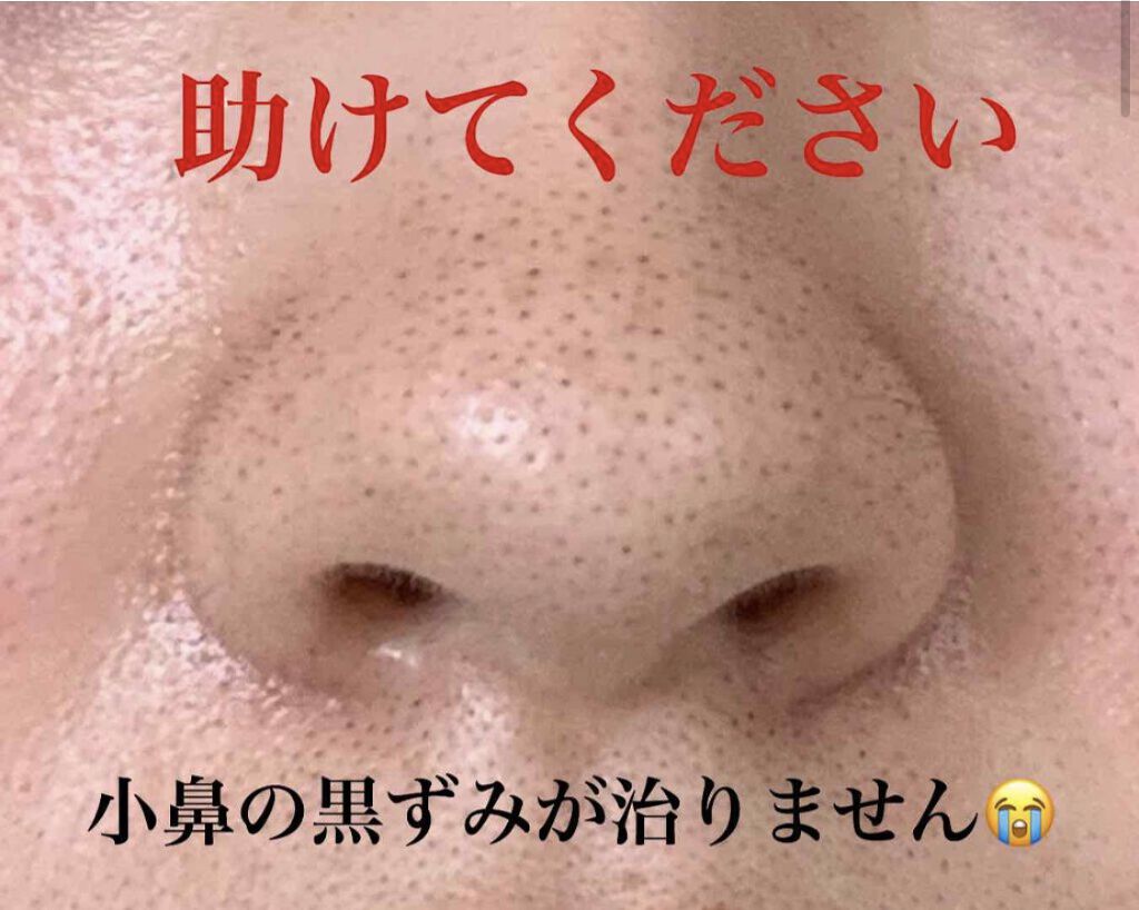 デュオ ザ クレンジングバーム ブラック/DUO/クレンジングバームを使ったクチコミ（2枚目）