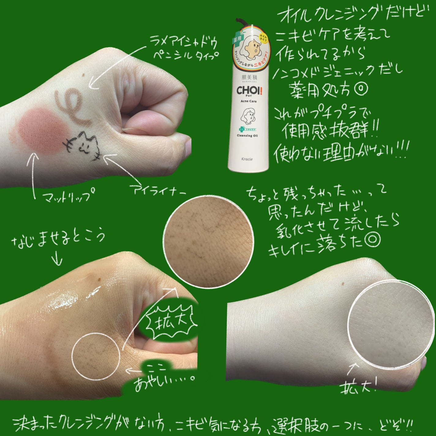 CHOIクレンジングオイル 薬用ニキビケア/肌美精/オイルクレンジングを使ったクチコミ(3枚目)