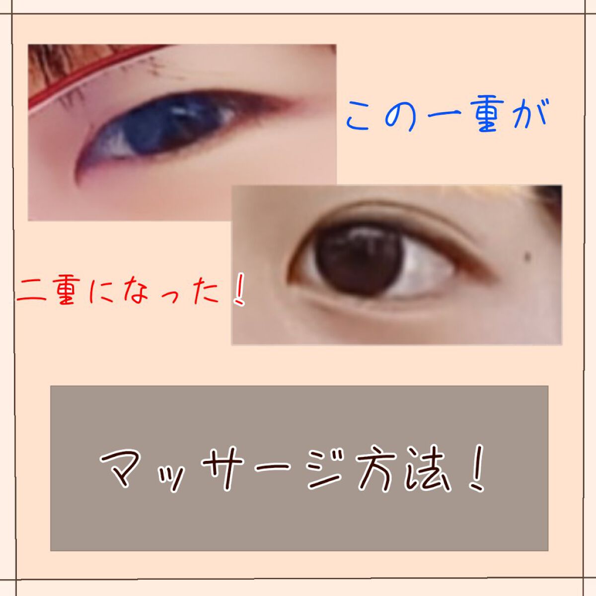 のびーるアイテープ（絆創膏タイプ、レギュラー）/DAISO/二重まぶた用アイテムを使ったクチコミ（1枚目）