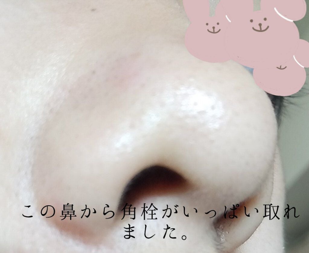 毛穴すっきりパック 鼻用 黒色タイプ/ビオレ/その他スキンケアを使ったクチコミ(2枚目)