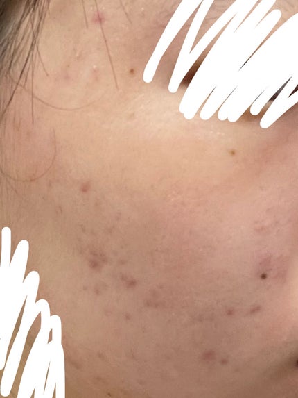 明色美顔水 薬用化粧水/美顔/化粧水を使ったクチコミ(3枚目)