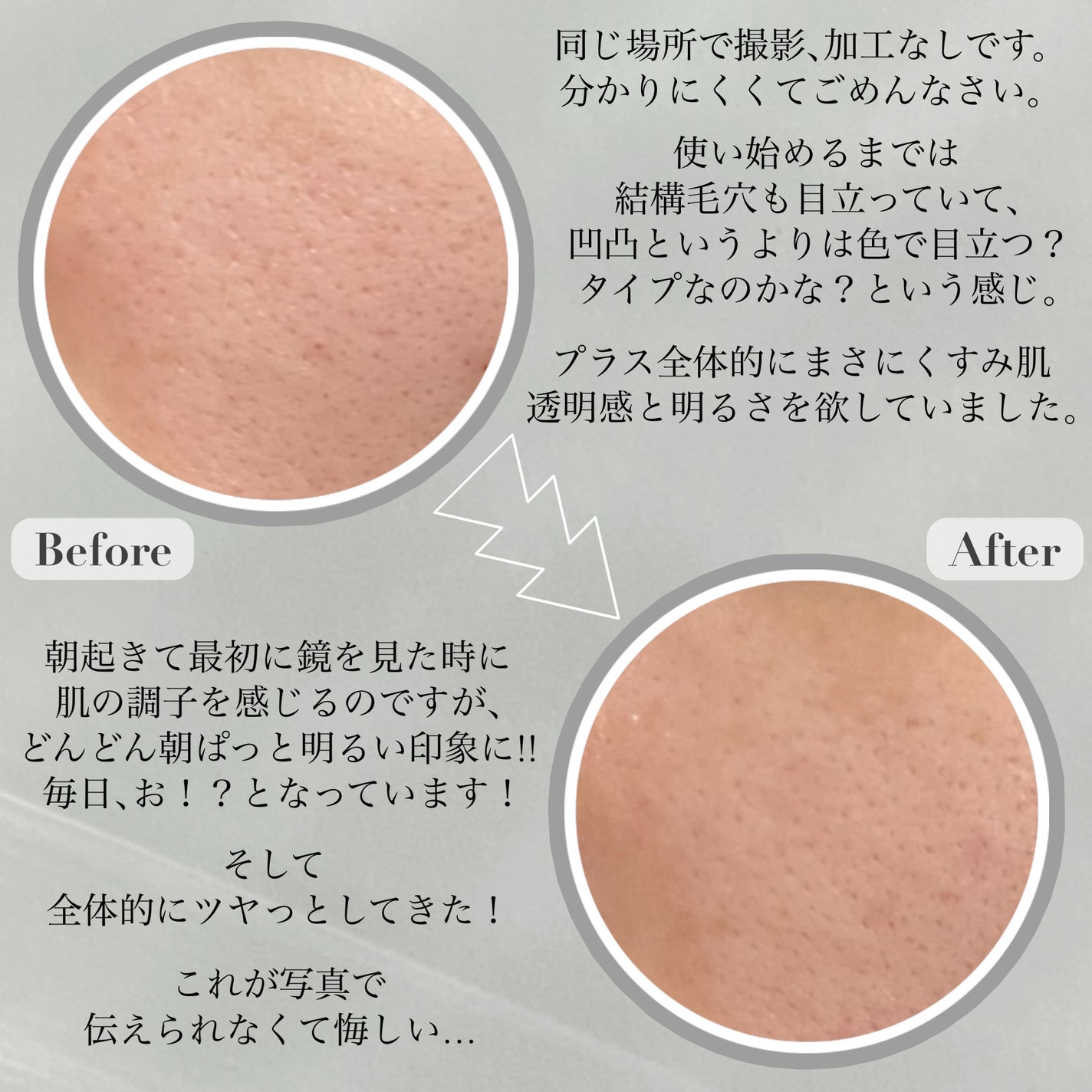 シカバイタル マスク/VT/シートマスク・パックを使ったクチコミ(5枚目)