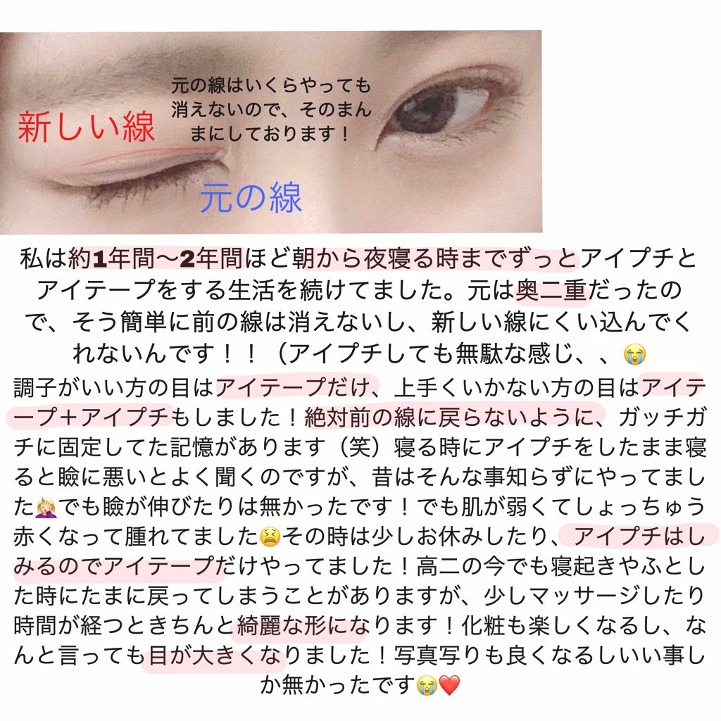 ダブルアイリキッド/Automatic Beauty/二重まぶた用アイテムを使ったクチコミ(3枚目)