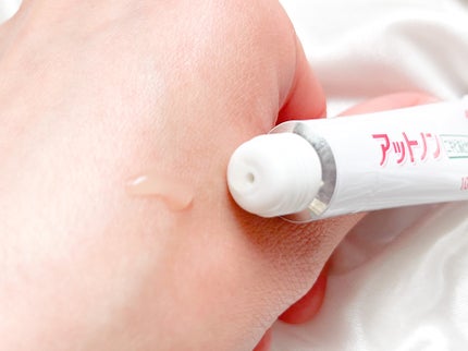 ニキビあとケアジェル/アットノン/その他スキンケアを使ったクチコミ(2枚目)