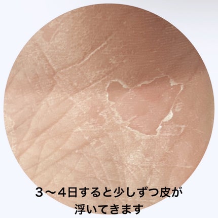 足裏角質ケアパック/3COINS/レッグ・フットケアを使ったクチコミ(4枚目)