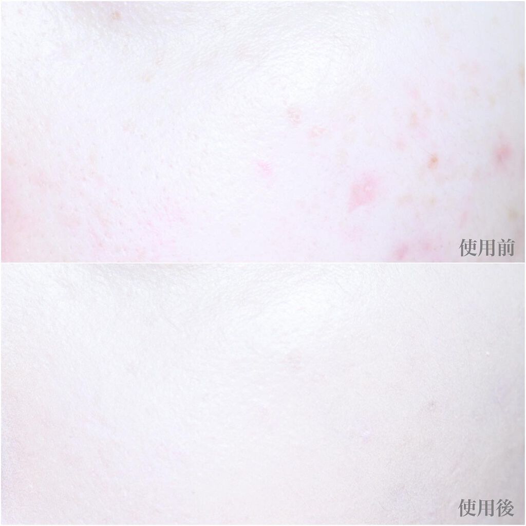 カバーステイWPファンデーションUV/コフレドール/パウダーファンデーションを使ったクチコミ(8枚目)