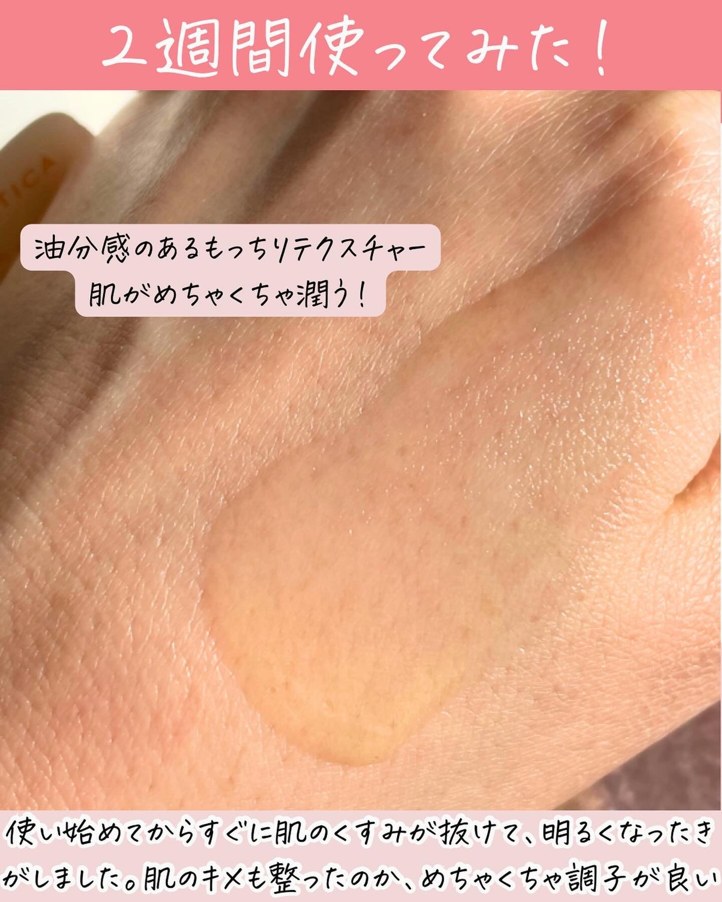 グロービタCトーニングセラム/AROMATICA/美容液を使ったクチコミ(4枚目)