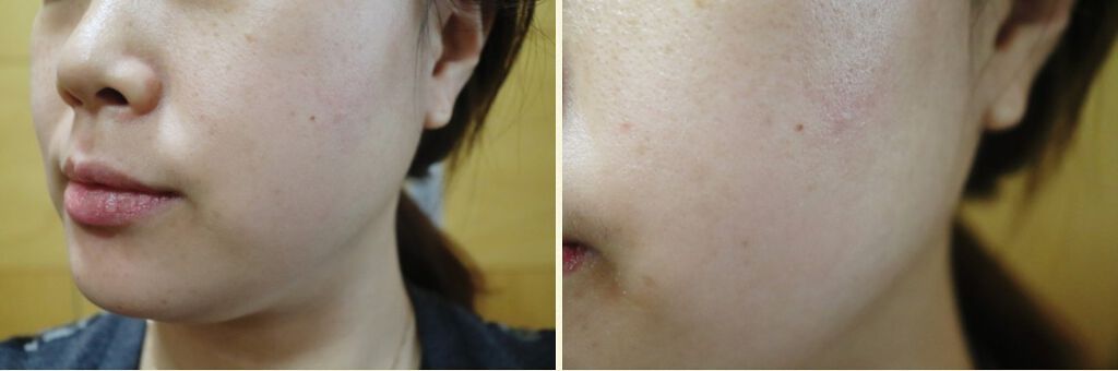 ゴールド ペプチド ブースティング アンプル/FEDORA AESTHETIC/美容液を使ったクチコミ（3枚目）