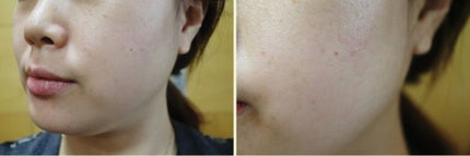 ダイヤモンド グロウ コーティング クリーム/FEDORA AESTHETIC/フェイスクリームを使ったクチコミ(1枚目)