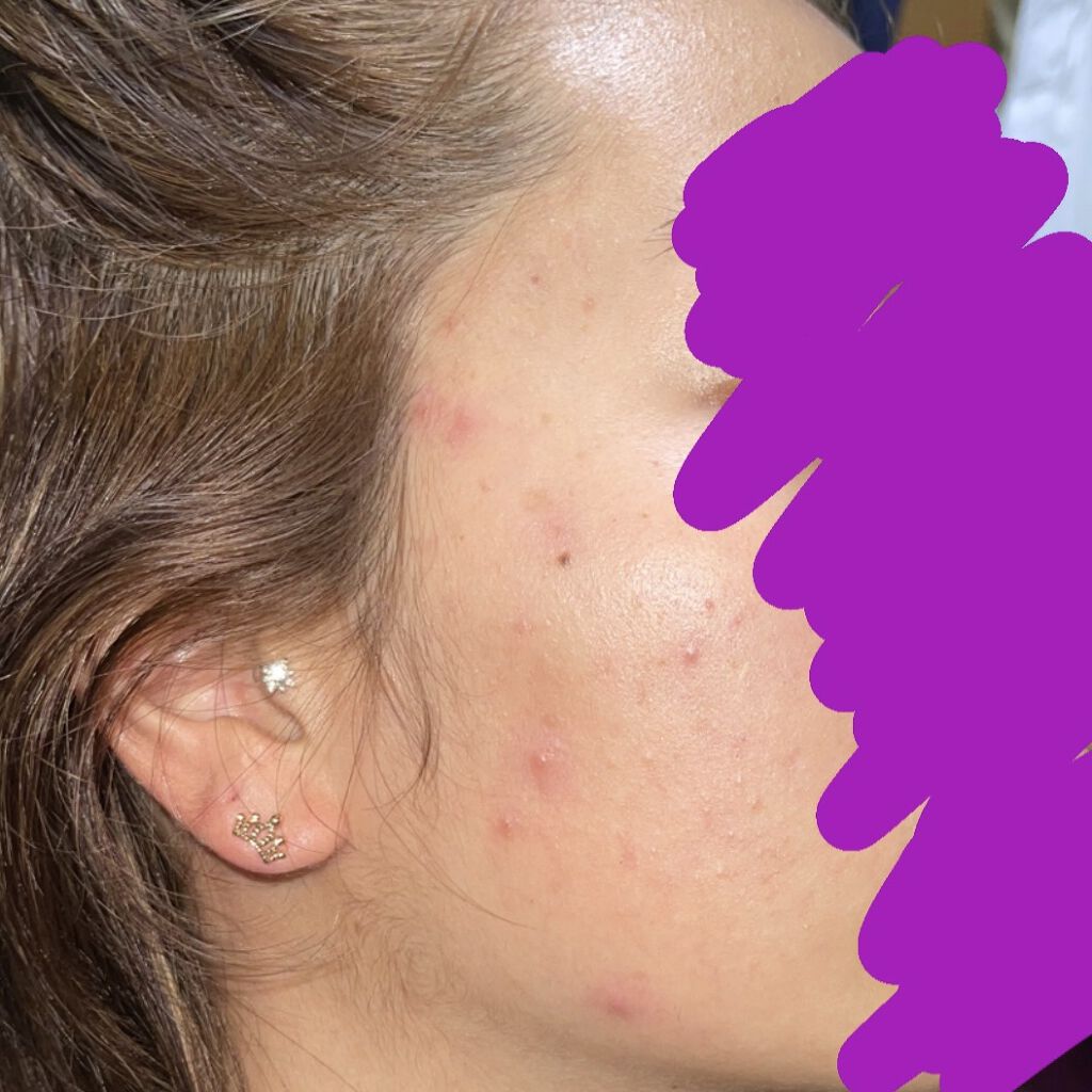 ル ブラン メークアップ リムーバー/CHANEL/クレンジングジェルを使ったクチコミ（1枚目）