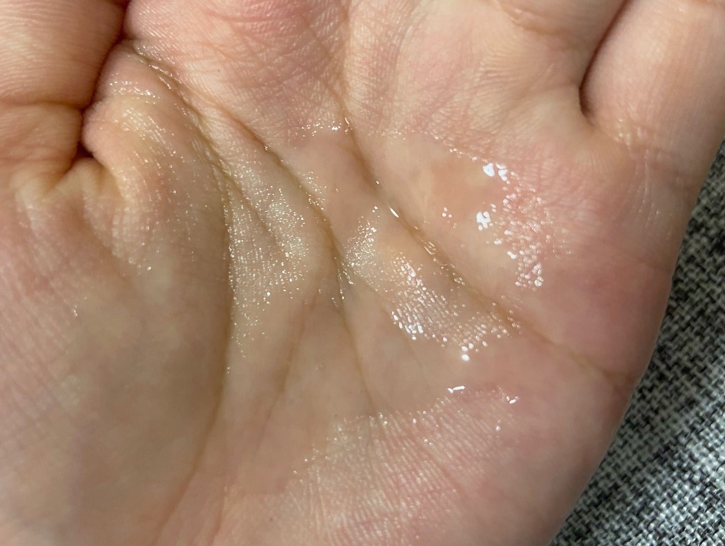 ノスカナイン トラブル セラム/FATION/美容液を使ったクチコミ(6枚目)