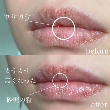 レブロン キス シュガー スクラブ/REVLON/リップスクラブを使ったクチコミ（3枚目）