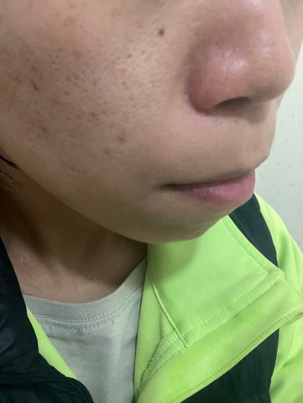 ðªððŽð²ð on LIPS ãæçš¿ãé
ããŸããðŠ1æ11æ¥æ¯ç©Žã¯ã»ãšãã©ç¡ãç¶æ
ã§ããããã..ãïŒ4æç®ïŒ