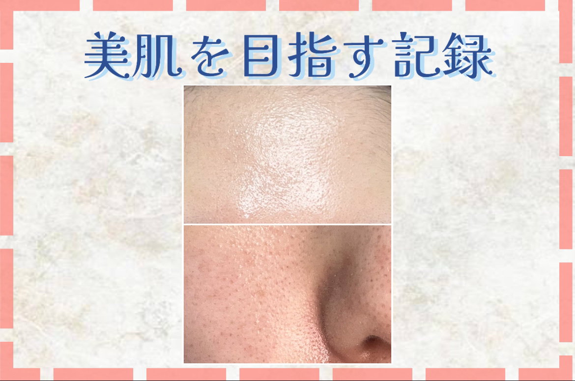 RMK Wトリートメントオイル/RMK/ブースター・導入液を使ったクチコミ（1枚目）