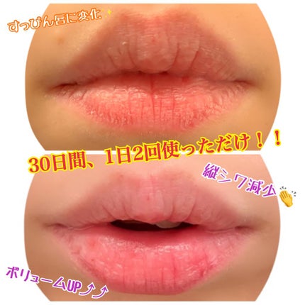 MAGIC LIPS/SERIOUS MODE/リッププランパーを使ったクチコミ(1枚目)