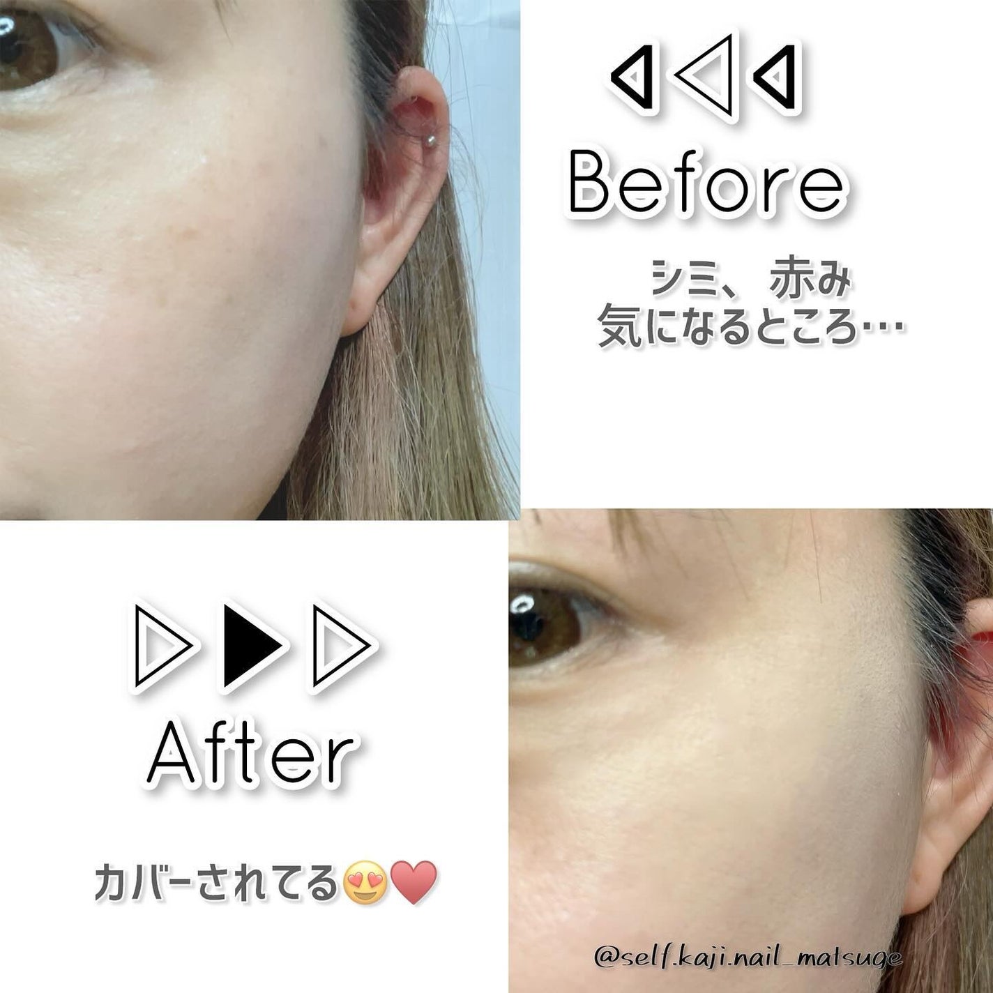 カバーアッププロコンシーラー/TFIT/パレットコンシーラーを使ったクチコミ(4枚目)