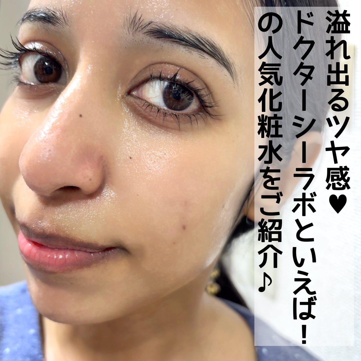 VC100エッセンスローション EX/ドクターシーラボⓇ/化粧水を使ったクチコミ(2枚目)