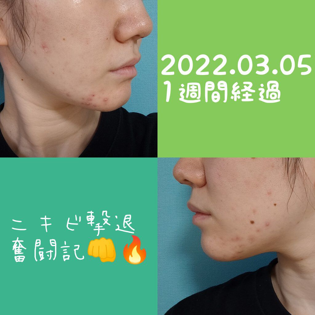 を使ったクチコミ（1枚目）