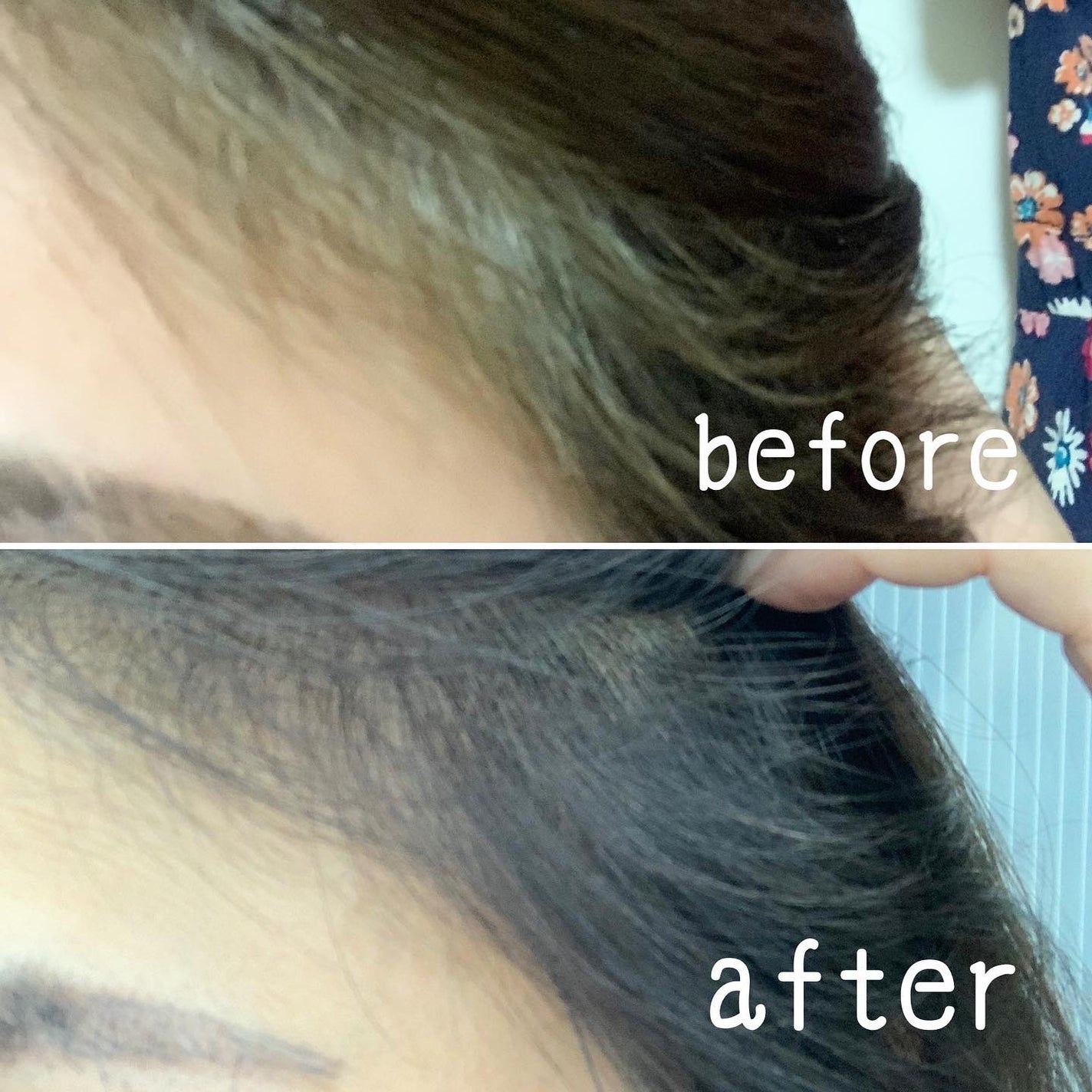 アンス on LIPS 「WELLATON2+1ウエラトーンツープラスワン自宅で簡単に使..」(5枚目)