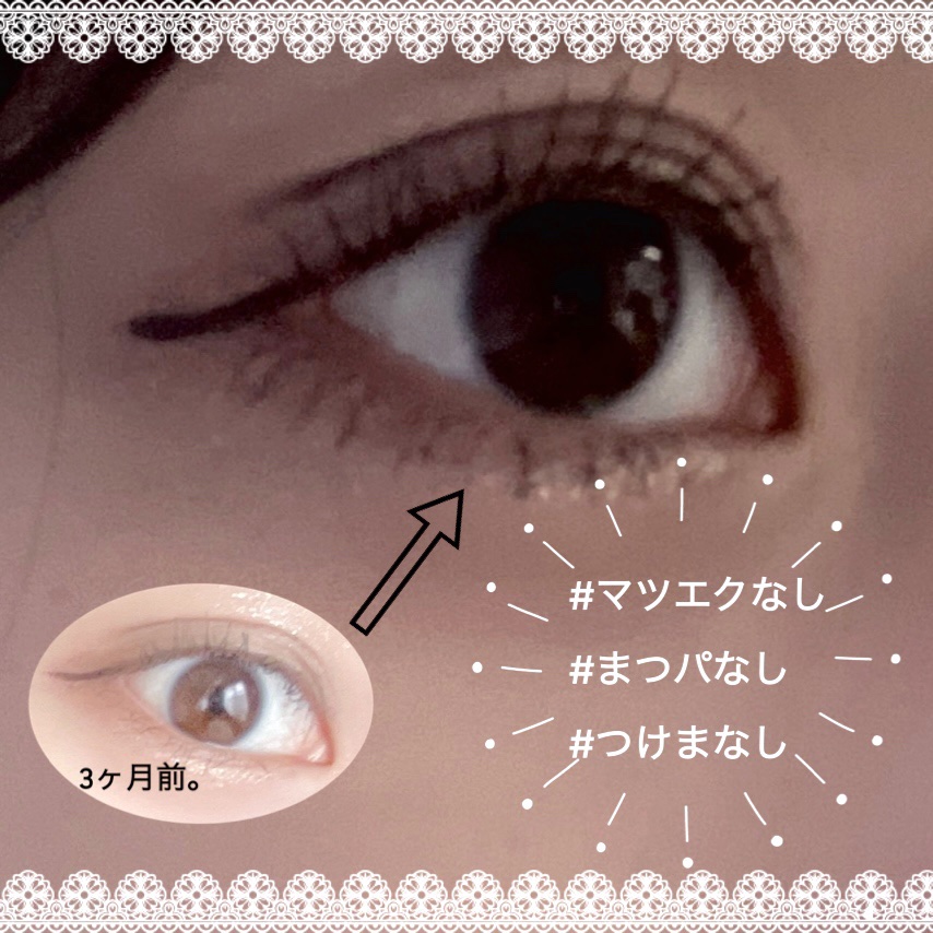 EMAKED（エマーキット）/水橋保寿堂製薬/まつげ美容液を使ったクチコミ（1枚目）