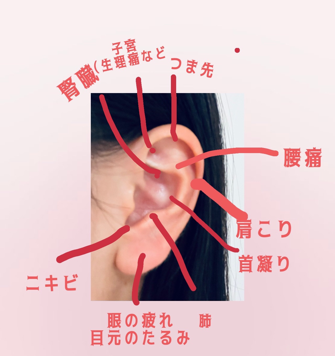 耳つぼジュエリー/Le BRILLANT/ボディグッズを使ったクチコミ（2枚目）