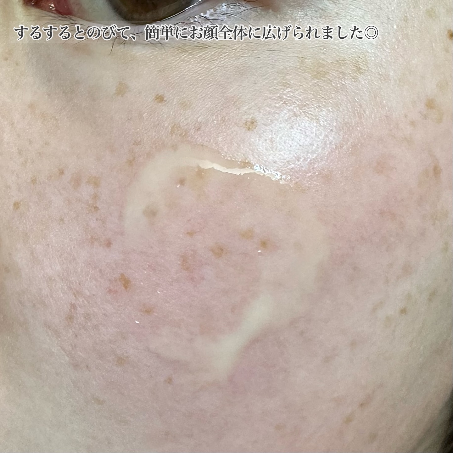 レチ二オールポアタイトニングセラム/Real Barrier/美容液を使ったクチコミ（3枚目）