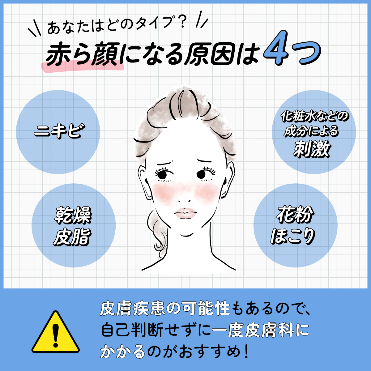 あなたはどのタイプ？赤ら顔になる原因はニキビ・乾燥皮脂・化粧水などの成分による刺激・花粉ほこりの4つ。皮膚疾患の可能性もあるので、自己判断せずに一度皮膚科にかかるのがおすすめ！
