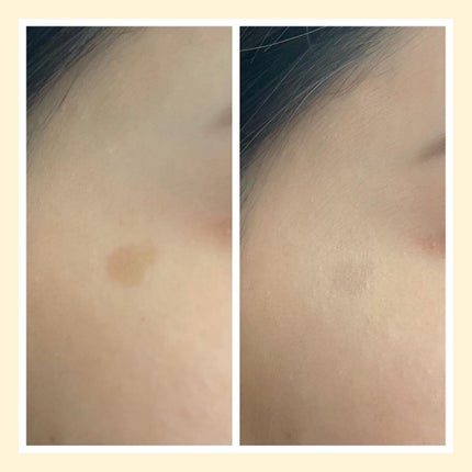 マスクフィットオールカバーデュアルコンシーラー/TIRTIR(ティルティル)/コンシーラーを使ったクチコミ(6枚目)