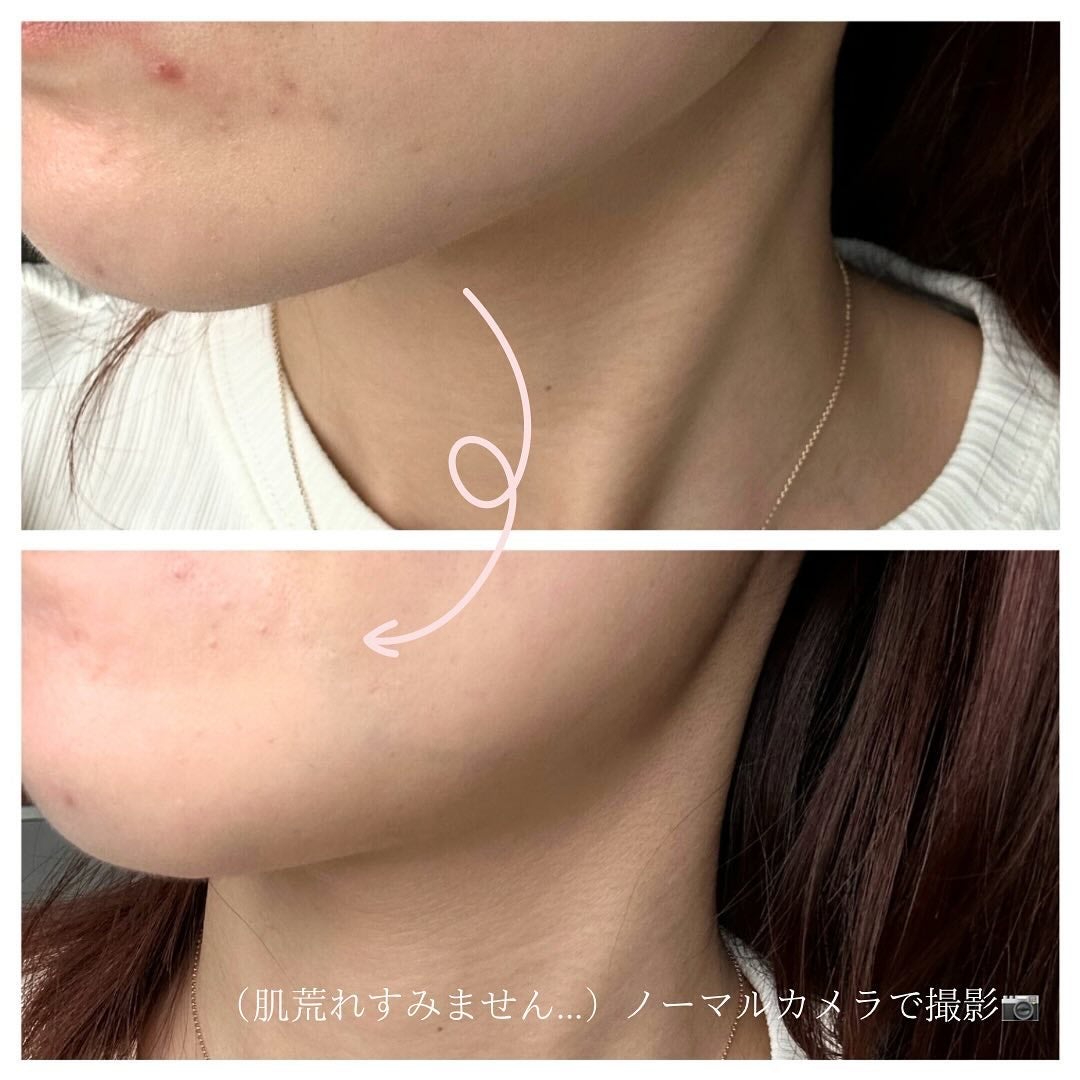 chi on LIPS 「【優秀カバーコスメ】 TIMAGE様よりコンシーラーパレッ..」(4枚目)