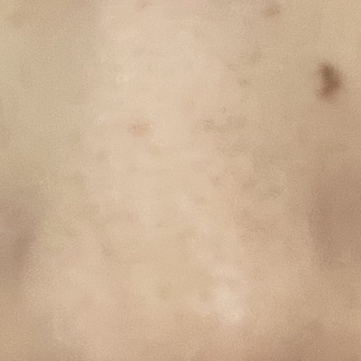 毛穴小町 ブラックピールオフパック/クリアターン/ピーリングを使ったクチコミ（2枚目）