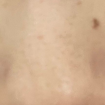 毛穴小町 ブラックピールオフパック/クリアターン/ピーリングを使ったクチコミ(2枚目)