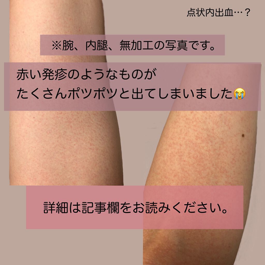 弱酸性ボディミルク/matsukiyo/ボディミルクを使ったクチコミ(2枚目)