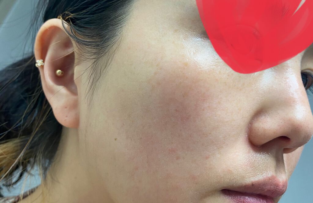 ザビタミンC23/IOPE/美容液を使ったクチコミ(3枚目)