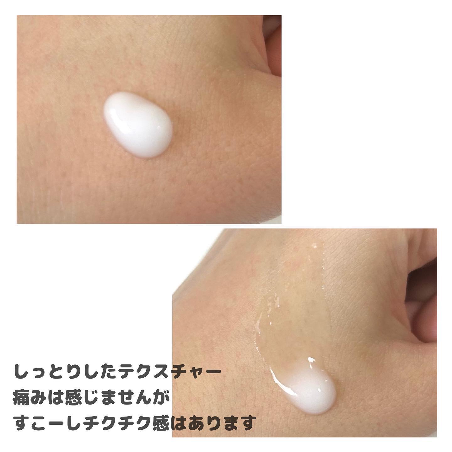 マイルドリードルショット50/VT/美容液を使ったクチコミ（3枚目）