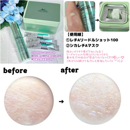 シカレチA マスク/VT/シートマスク・パックを使ったクチコミ(6枚目)