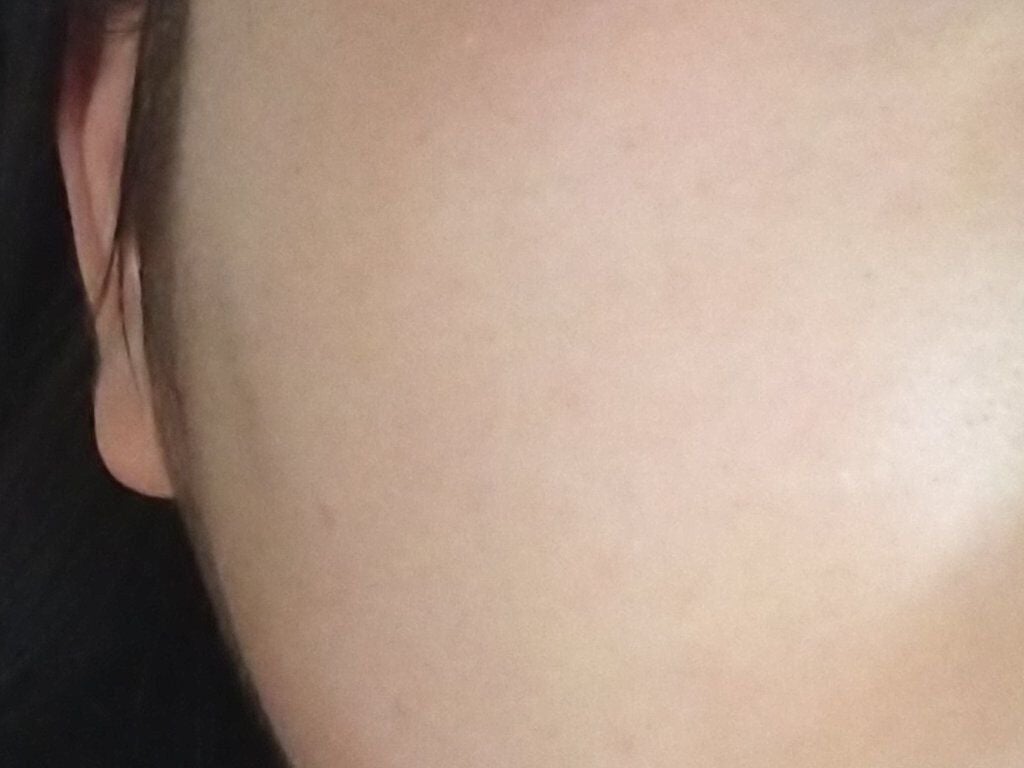 スーパー毛穴ピールセラム/ラボラボ/美容液を使ったクチコミ(3枚目)