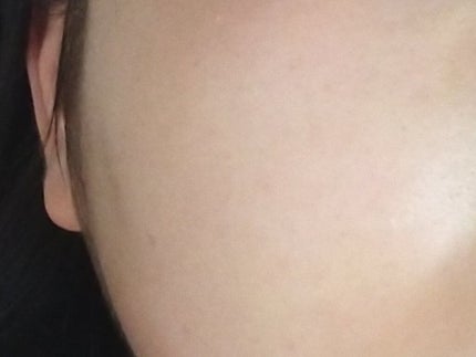 スーパー毛穴ピールセラム/ラボラボ/美容液を使ったクチコミ(3枚目)