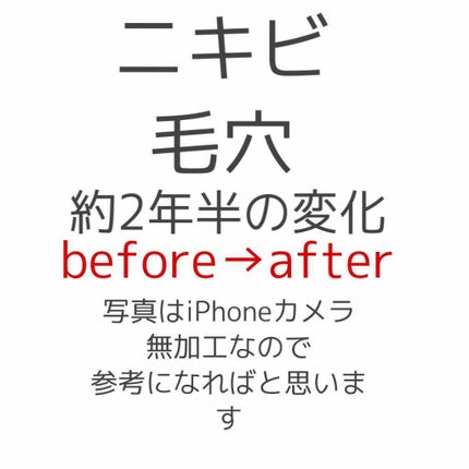 敏感肌用薬用美白美容液/無印良品/美容液を使ったクチコミ(1枚目)