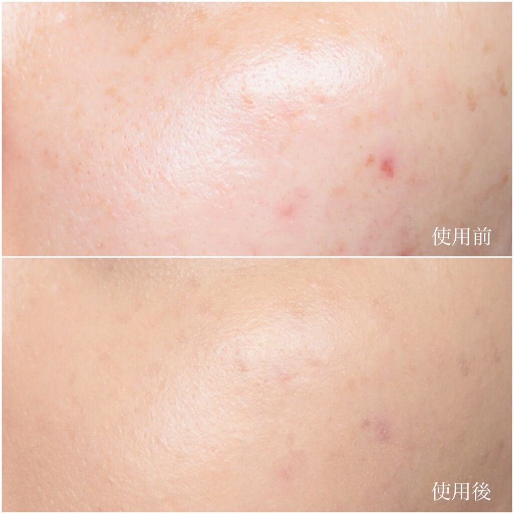 ボーン ディス ウェイ アンディテクタブル 24H マット ファンデーション/Too Faced/リキッドファンデーションを使ったクチコミ(5枚目)