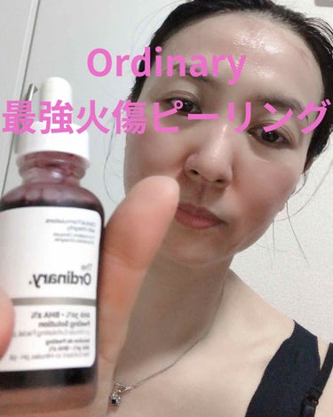 AHA 30% + BHA 2% Peeling Solution/The Ordinary/ピーリングを使ったクチコミ（1枚目）