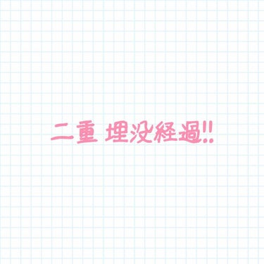 あやりんご🍎 on LIPS 「久々の投稿!!二重整形埋没法をしてから4ヶ月程経ちまして、、、..」（1枚目）