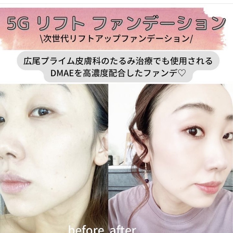 5G リフト ファンデーション/ドクターソワ/クッションファンデーションを使ったクチコミ（2枚目）