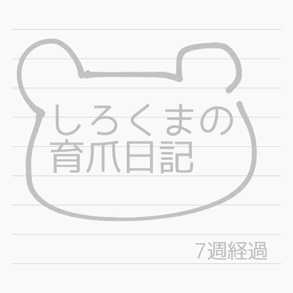 ネイルサポート Na/ネイルネイル/ネイルトップコートを使ったクチコミ(1枚目)