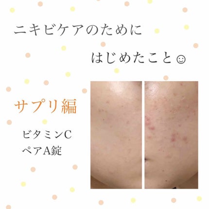 DHC ビタミンCハードカプセル/DHC/美容サプリメントを使ったクチコミ(1枚目)