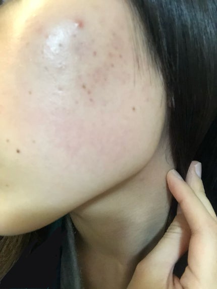 マルチビタミン/DAISO/健康サプリメントを使ったクチコミ(3枚目)