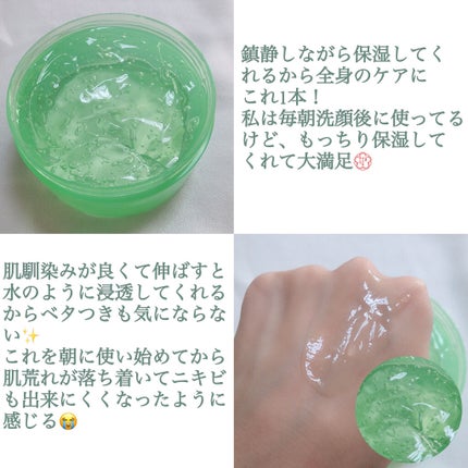 ティーツリーカーミングハイドロジェル/MEDIHEAL/ボディローションを使ったクチコミ(3枚目)