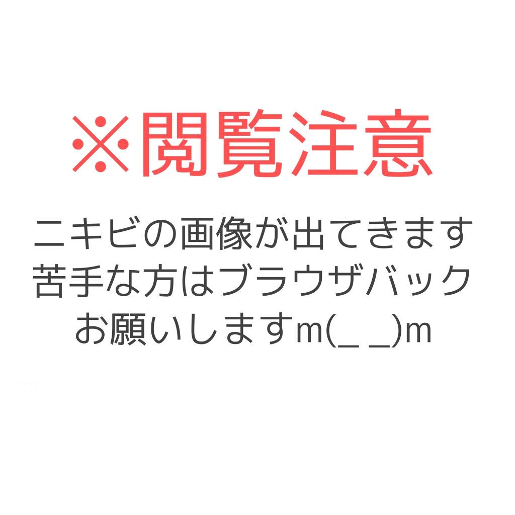 オロナインH軟膏 (医薬品)/オロナイン/その他を使ったクチコミ(1枚目)