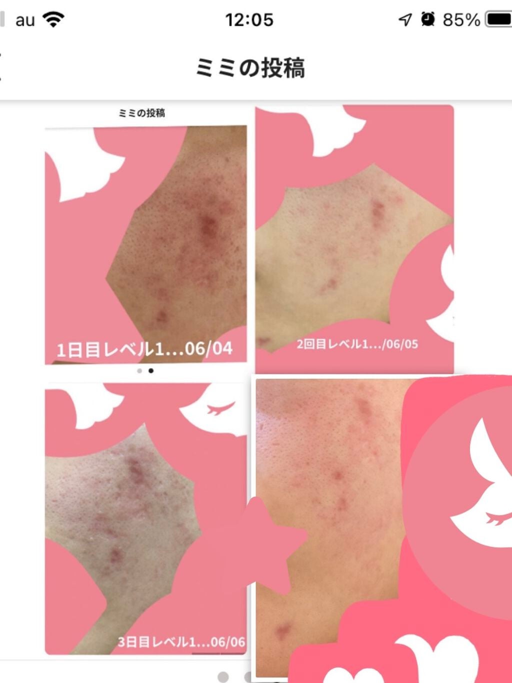 薬用しみ対策 美白化粧水 しっとりタイプ/メラノCC/化粧水を使ったクチコミ(3枚目)