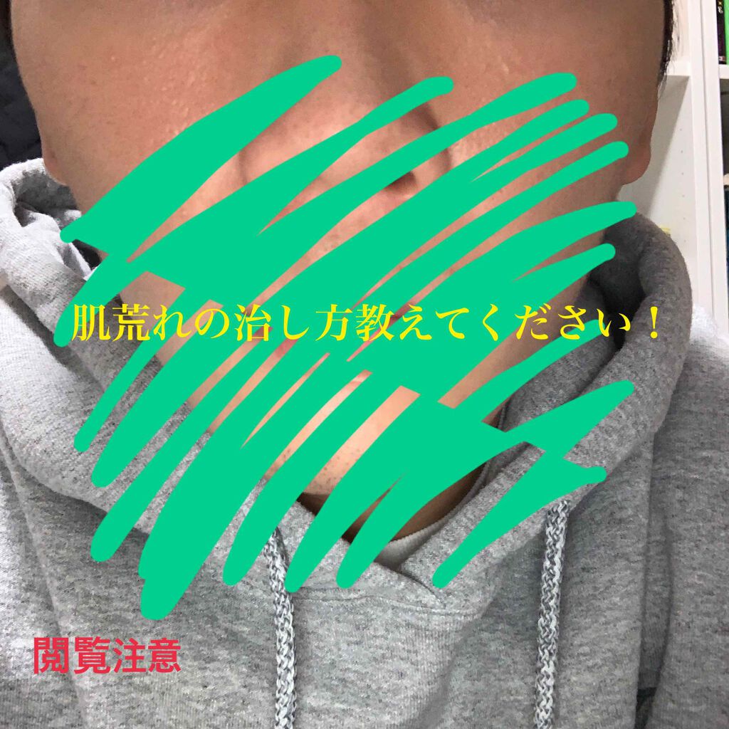 ホワイトアップ ローション(III)/アクアレーベル/化粧水を使ったクチコミ（1枚目）